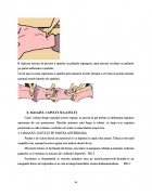 Atestat Rolul masajului in spondiloza vertebrala - imaginea53