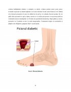 Atestat Îngrijirea persoanei vârstnice cu diabet zaharat - imaginea31