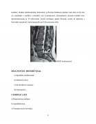 Atestat Îngrijirea pacienților cu lombosciatică - imaginea11