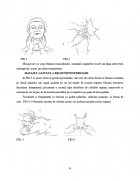 Atestat Rolul masajului in spondiloza vertebrala - imaginea54