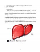 Atestat Îngrijirea pacientului cu ciroză hepatică - imaginea6