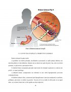 Atestat Îngrijirea persoanei vârstnice cu diabet zaharat - imaginea16